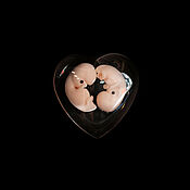 Куклы и игрушки handmade. Livemaster - original item Embryos of twins 7 weeks, 7 weeks of pregnancy. Handmade.