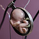 Fetus - в ожидании чуда, серебро 925, Подвеска, Москва,  Фото №1